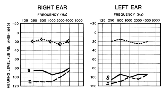 AccessAudio_3_12_YOM