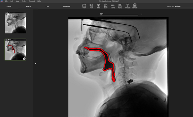 TIMS Medical MVP 5.0 Software